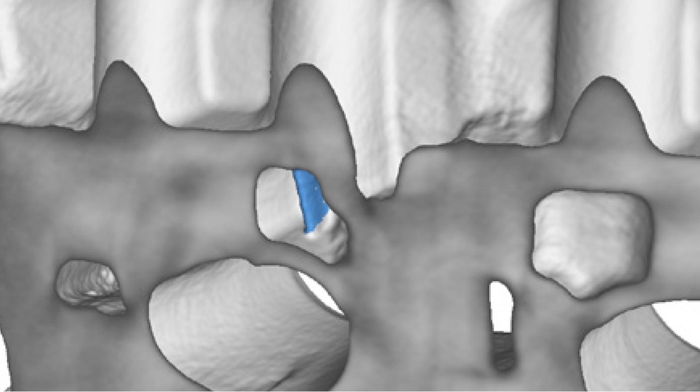 ZEISS slomljeno jezgro kod livenja lakih metala