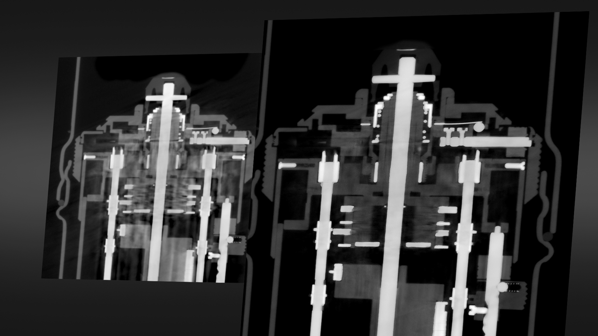 Napredno smanjenje artefakata kod mešovitih materijala (AMMAR)​